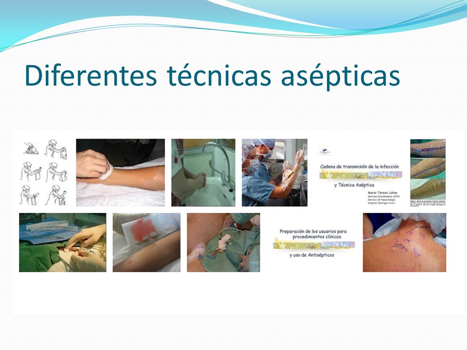 que es tecnicas asepticas
